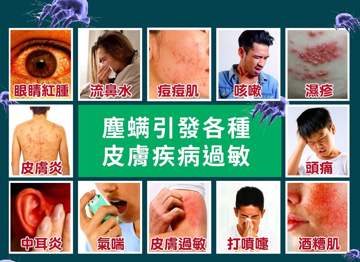 螨博士除螨清洗加盟過敏